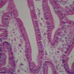 Orletto a Spazzola e Trasporto dei Monosaccaridi nell'Enterocita Assorbimento Intestinale